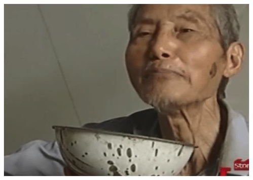精神病患残忍抠出老人眼球，官方回应引发社会热议